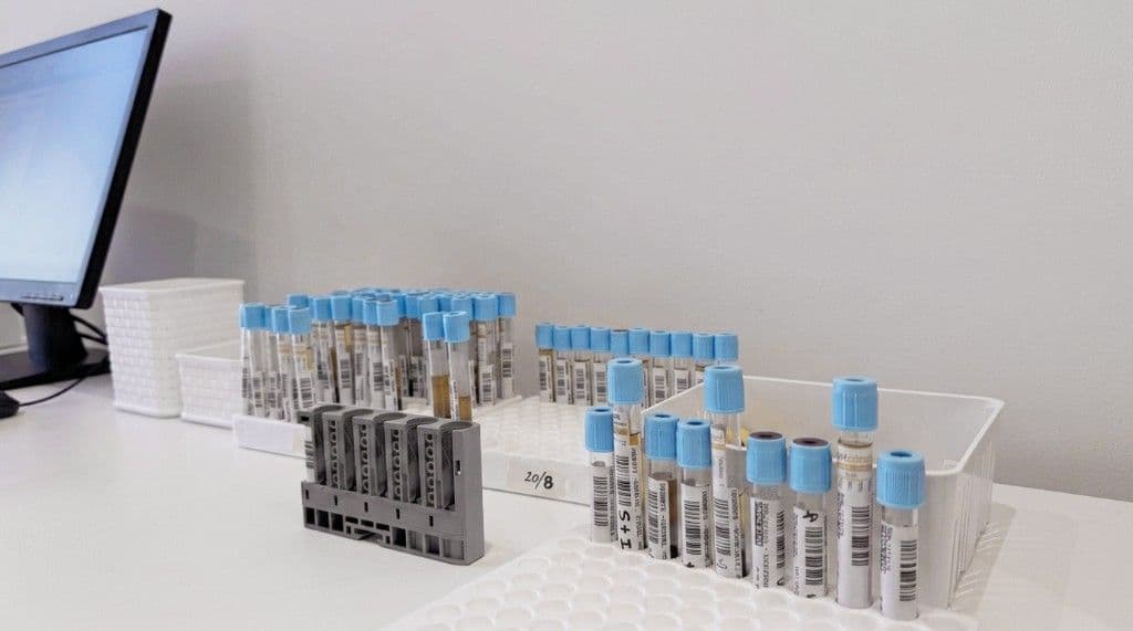 Muestras identificadas en el laboratorio